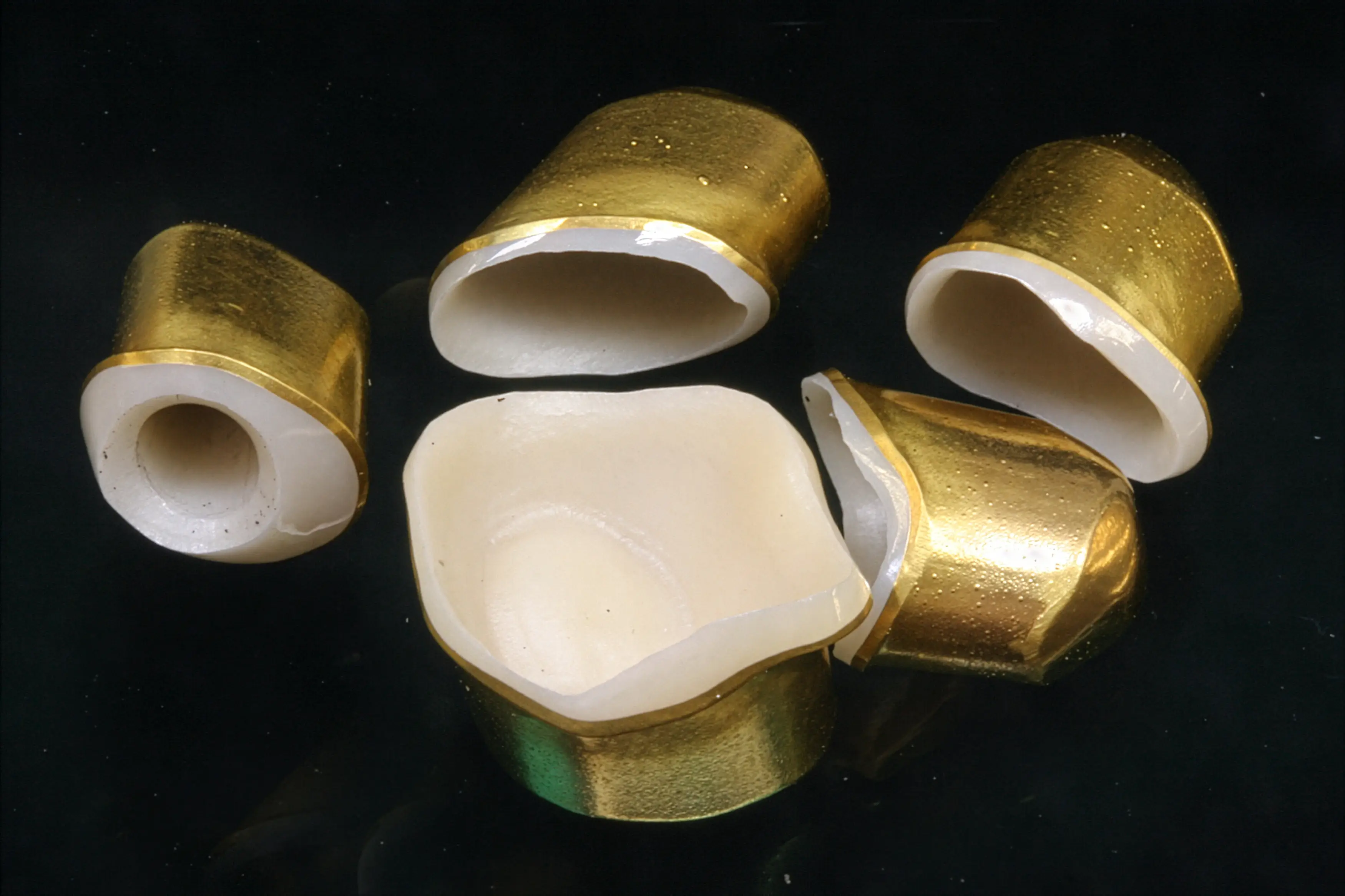 Goldene Galvanokappen auf Zirkon-Primärkronen